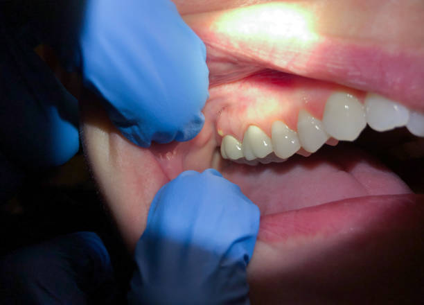 Best Orthodontic Emergency Dentist in Culver City, CA